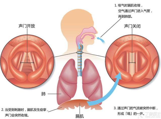 经常打嗝到底是咋回事？如果这样打嗝，你得当心了！